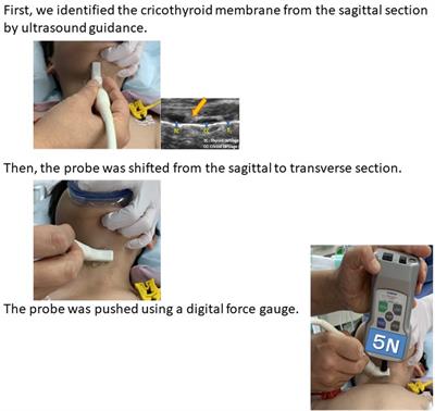 Analysis of pressure-induced deviation of the cricothyroid membrane among pediatric patients